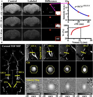 Age-Related Alterations in Brain Perfusion, Venous Oxygenation, and Oxygen Metabolic Rate of Mice: A 17-Month Longitudinal MRI Study